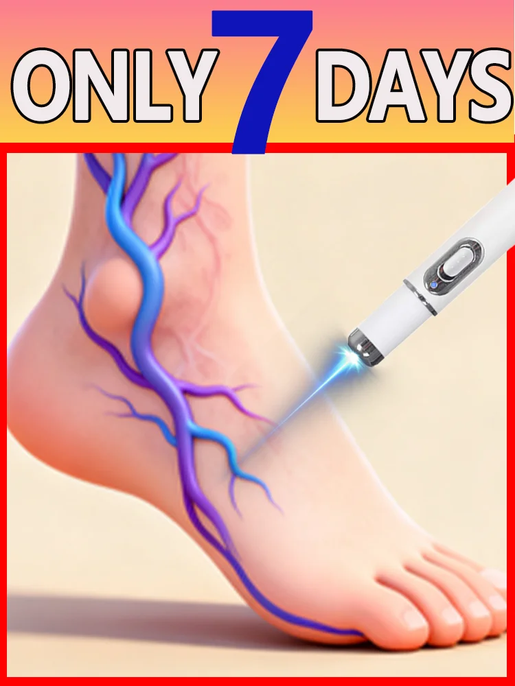 

Leg care tools Reduce Uncomfortable For Legs Improving Blood Circulation Varicose Veins Pen Skin Care Product