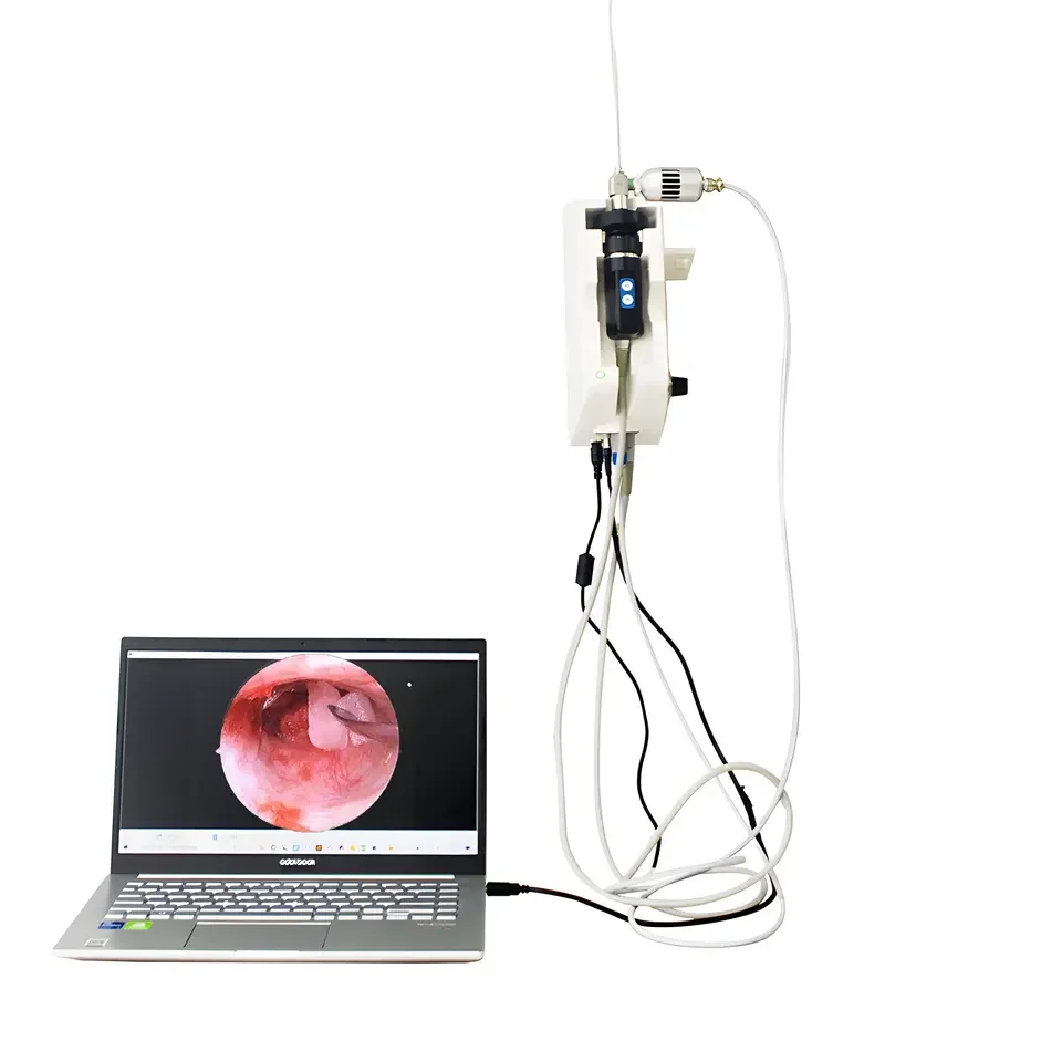 Image 3: Système d'endoscope rigide de dispositif médical pour la vente d'endoscope système d'endoscopie d'article en acier inoxydable de croix blanche noire transparente maximum