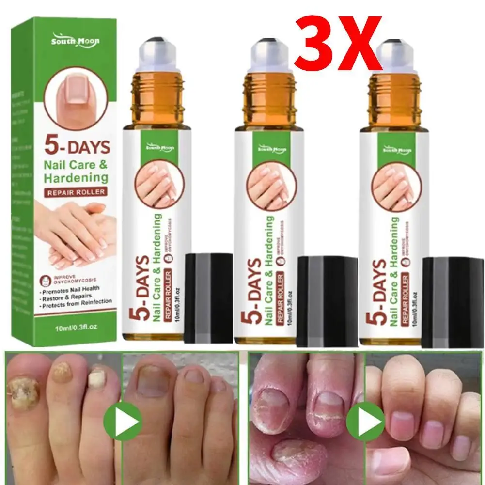 3X Nail Growth Hardening Repair Roller Nail Repair Softening Nails Removing Thickening Nail Brightening Nutrient Solution Care