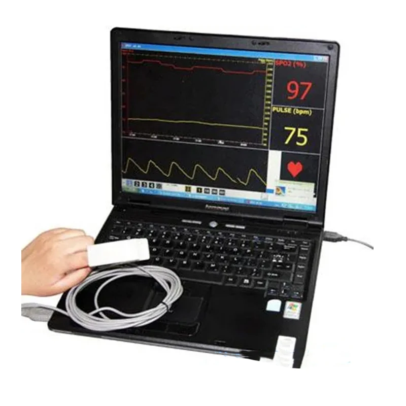 CONTEC CMS-P Can be Connected to the Computer\'s blood oxygen probe including software