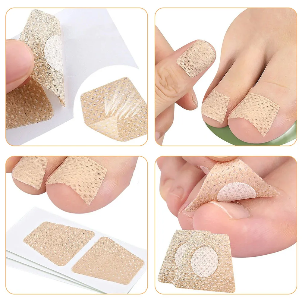 30 hojas de parches correctores de uñas encarnadas, tela no tejida, Corrector de uñas de los pies, parches para el cuidado de los pies, herramientas de cuidado de pedicura