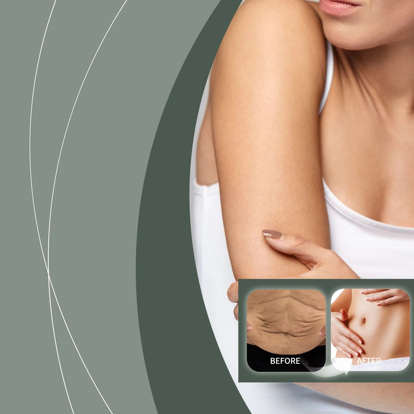 ファーミング ボディ オイル - 肌の引き締めのためのスカルプティング & トーニング トリートメント、抗セルライト マッサージ オイル - 100ml/3.38oz