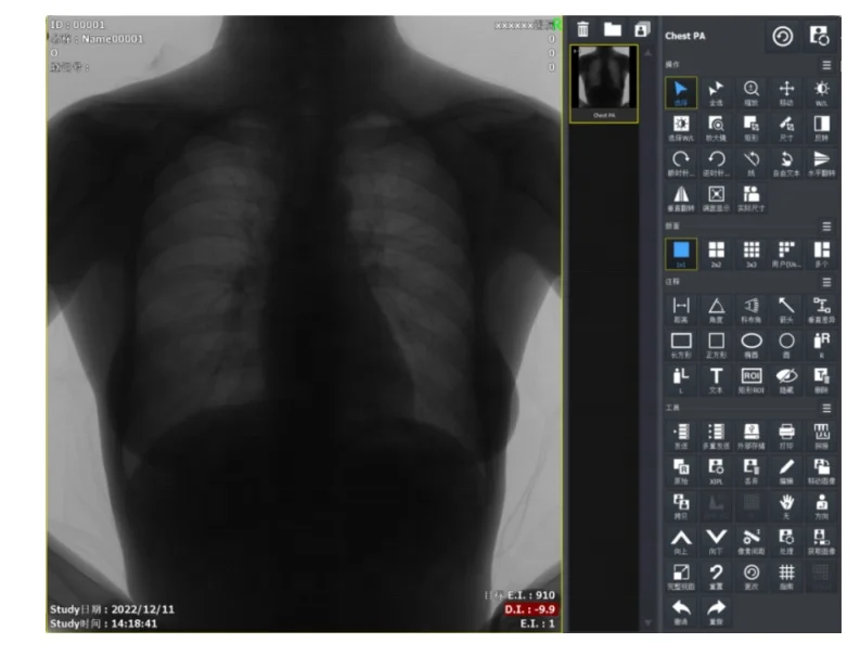 Latest Design Mobile Radiography High Frequency Medical X Ray Imaging X-Ray Medical Jiangsu Medical-X-Ray-Machine Price