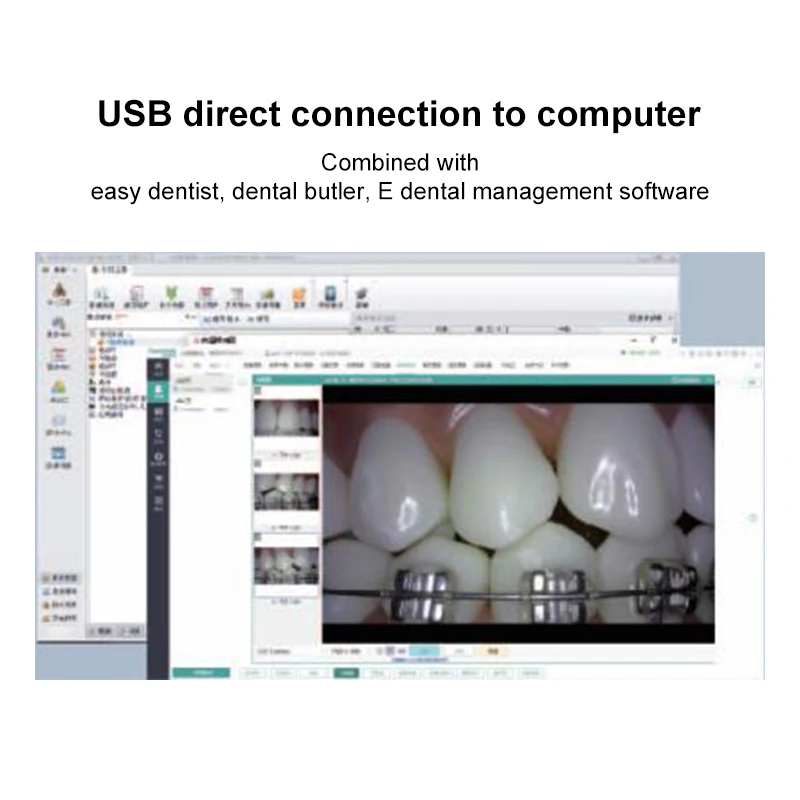 VV Dental 13MP Intraoral Camera No Delay and Smart Focus 4K Image USB Intra Oral Camera With Induction Bracket CF-686B