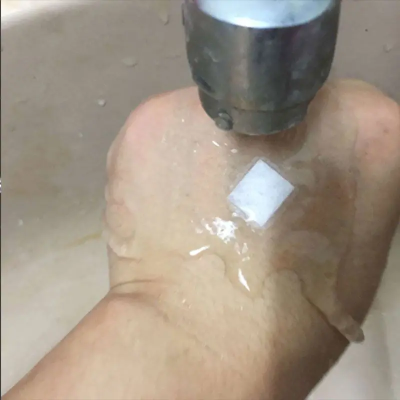 100 stücke Runde Pflaster Körper Wunde Hämostase Aufkleber Für Baby Haut Atmungsaktive Wasserdichte Transparen Erste Hilfe Verband – Detail 4