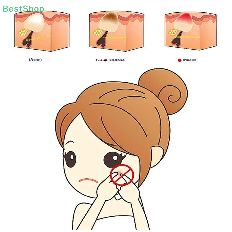 Pince à épiler pour points noirs d'acné, Clip à crochet en forme de 7, beauté du visage, outils pour enlever l'acné, pour les soins de la peau