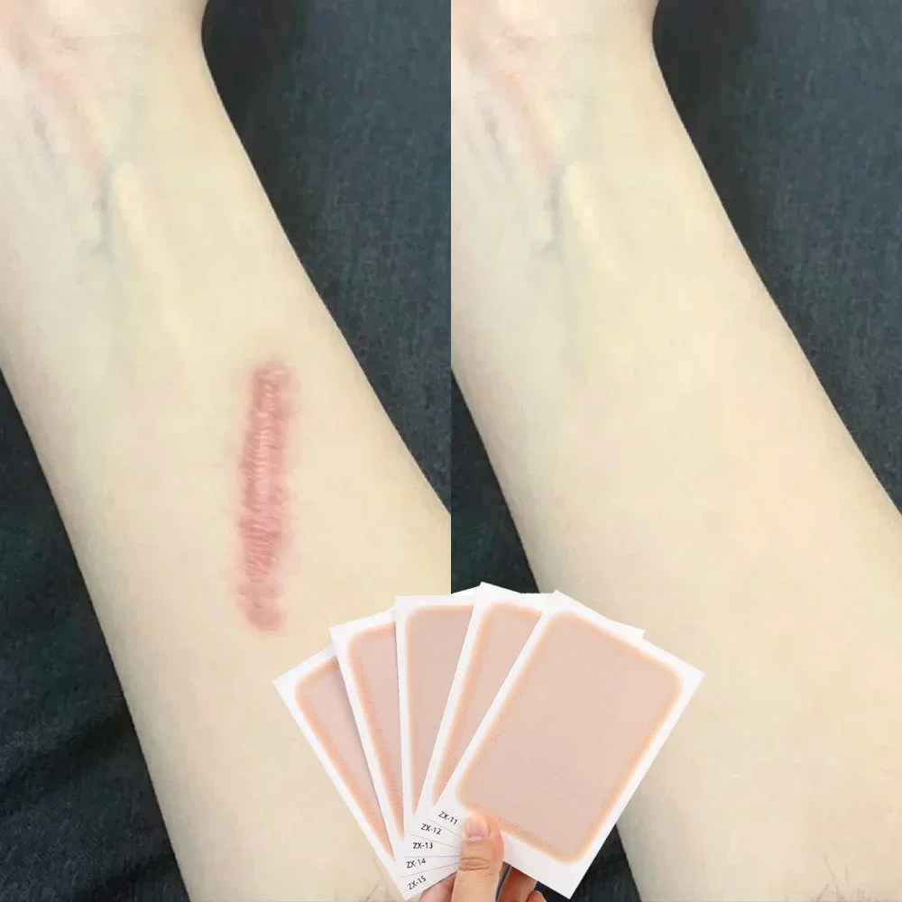 Ultra Thin Tattoo Flaw Concealing Tape Unisex Waterproof Full Cover Concealer Stickers Body Arm Temporary Concealing Scar Cover