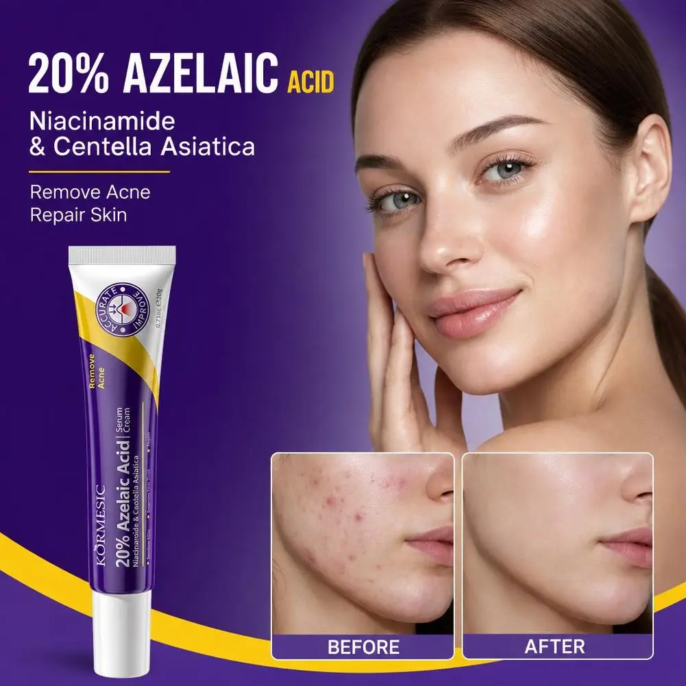 20 % Azelainsäure-Essenz, tiefenwirksame Feuchtigkeitscreme für die Gesichtspflege, zur Akneentfernung und Hautglättung, multifunktionale Gesichtscreme, 20 g. – Detail 3