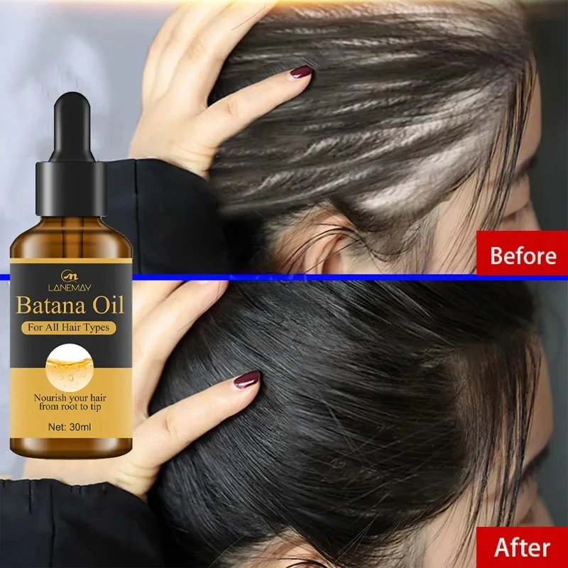 7 Days Fast Batana Oil Hair Growth Serum Anti-loss Hair Regrowth Products Repair Damaged Hair Roots Hair Care For Women Men