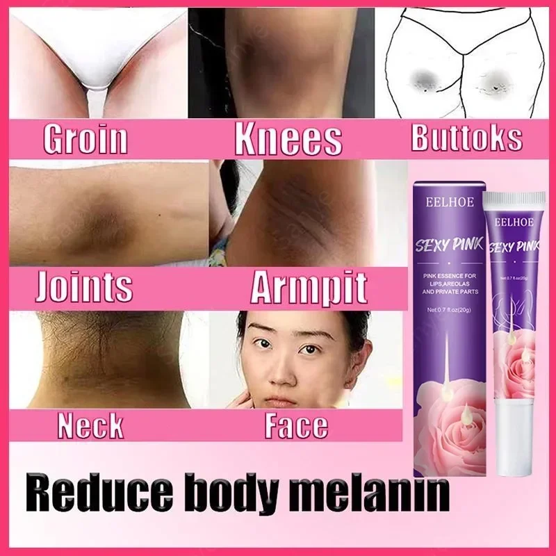 Women Skin Whitening Cream Remove Melanin Emulsion Brighten Private Parts Whiten Cream Inner Thigh Butt Underarm Bleaching Serum