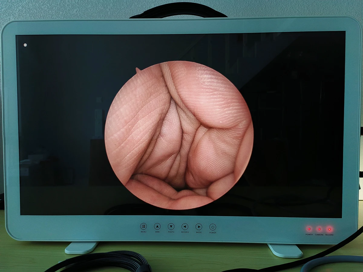 Camjoy 27 Inch Portable 4 in 1 Medical Diagnostic Endoscope  with Integrated Video System