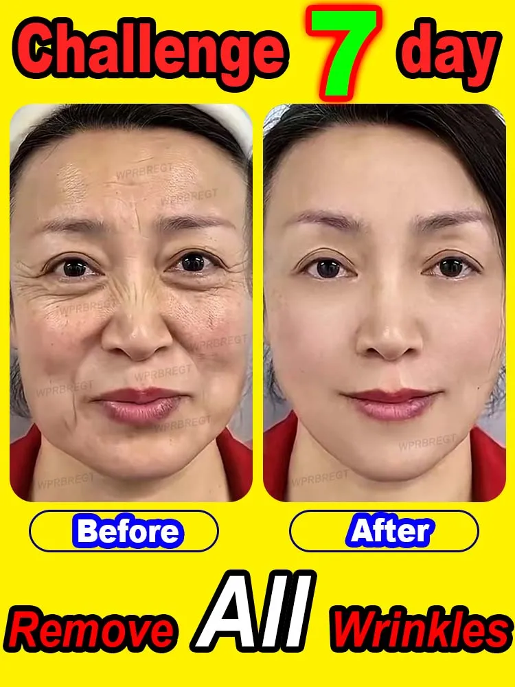 

20 years younger, no fine lines