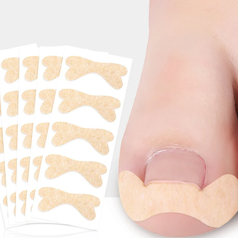 

30pcs Toenail Ingrown Toenail Tool Sticker Toe Nail Patch Correction Tool Breathable Premium Material for Nail Care