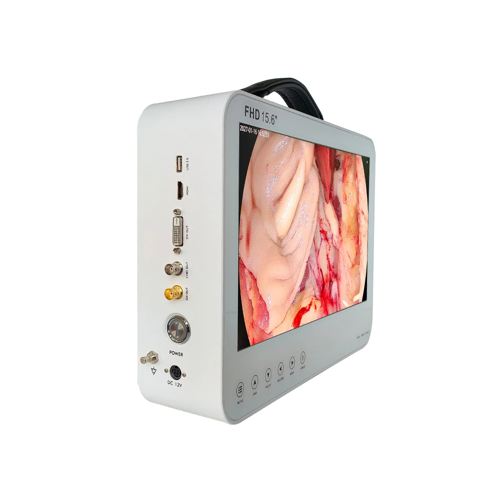 Camjoy 15.6 Inch Portable Full HD Endoscopy Camera For ENT Laparoscopy Urology PTSD