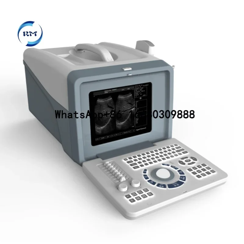 Human use Clinic Medical Black and White Ultrasonic Machine Full Digital LED Portable Ultrasound Scanner