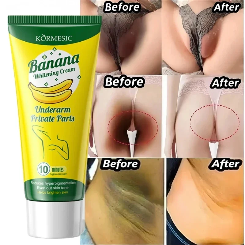 

Whitening Cream Private Parts Underarm Bleaching Lotion Whiten Butt Knee Brighten Inner Thigh Intimate Parts Dark Remove Melanin