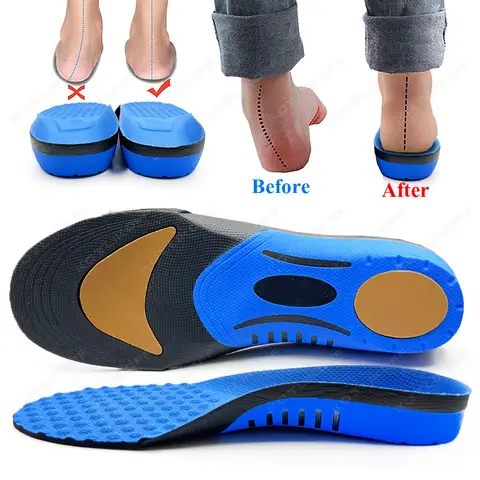발을위한 최고의 안창 정형 외과 Valgus Insoles 템플릿 플랫 발 아치 러닝 아치 지원 신발 액세서리 삽입 남성 여성 발을위한 최고의 안창 정형 외과 Valgus Insoles 템플릿 플랫 발 아치 러닝 아치 지원 신발 액세서리 삽입 남성 여성