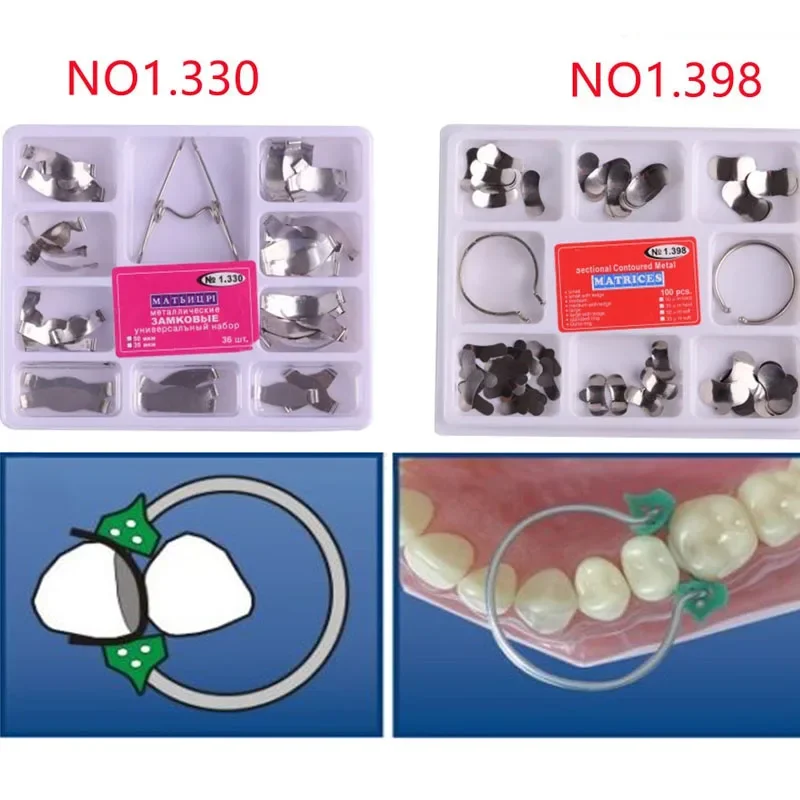 치과용 매트릭스 링 단면 윤곽 매트릭스 리필 밴드 1.398 1.330 클램핑 분리 링 추가 웨지 플라이어