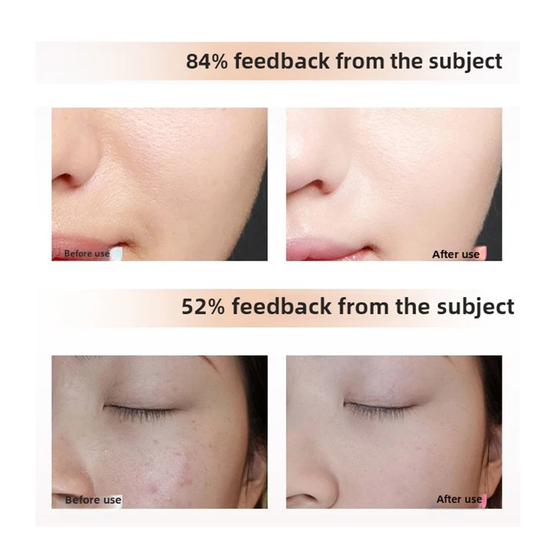 Panel de terapia de luz LED inalámbrico Terapia LED de fotones profesional para rostro y cuerpo Resultados brillantes de 7 días Spa en casa