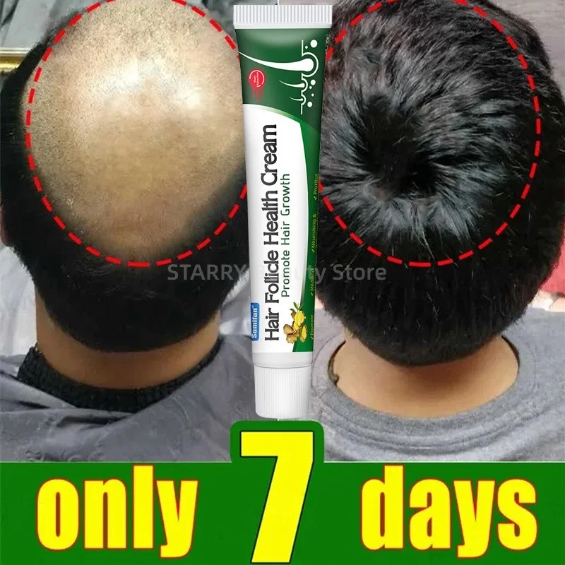 

Ginger Hair Regrowth Cream Anti Hair Loss Dense Hair Soft Long Hair Repair Dry Damaged Frizz Relieving Scalp Treatments Products