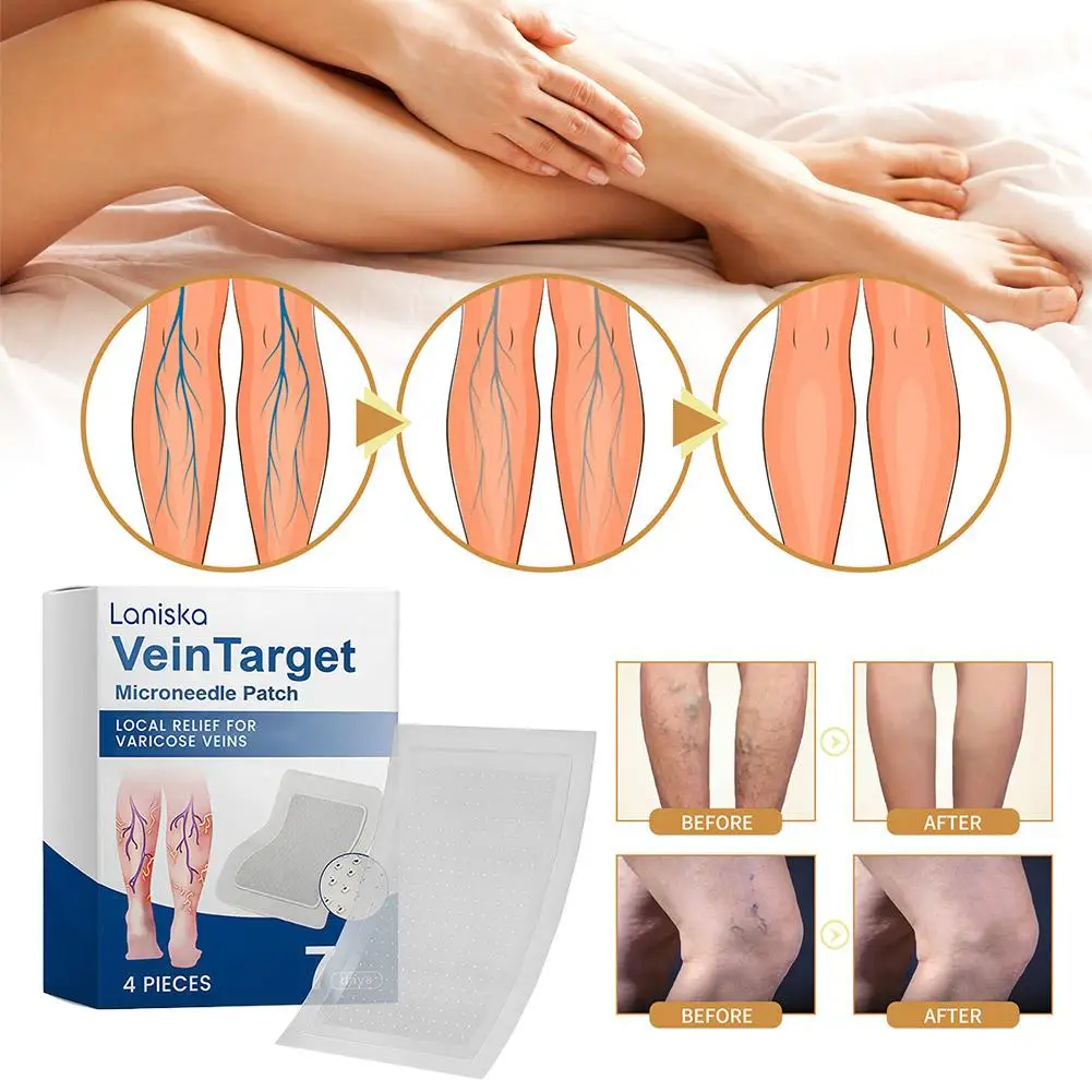 Varicose Vein Relief Patches with Cooling Plant Extracts Non Greasy Promotes Blood Circulation Lightweight Easy to Apply view 4