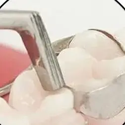 

Ремешок для стоматологических инструментов, толкатель, лента для лифта, сиденье, стоматологическая лаборатория, автоклавируемая ручка инструмента