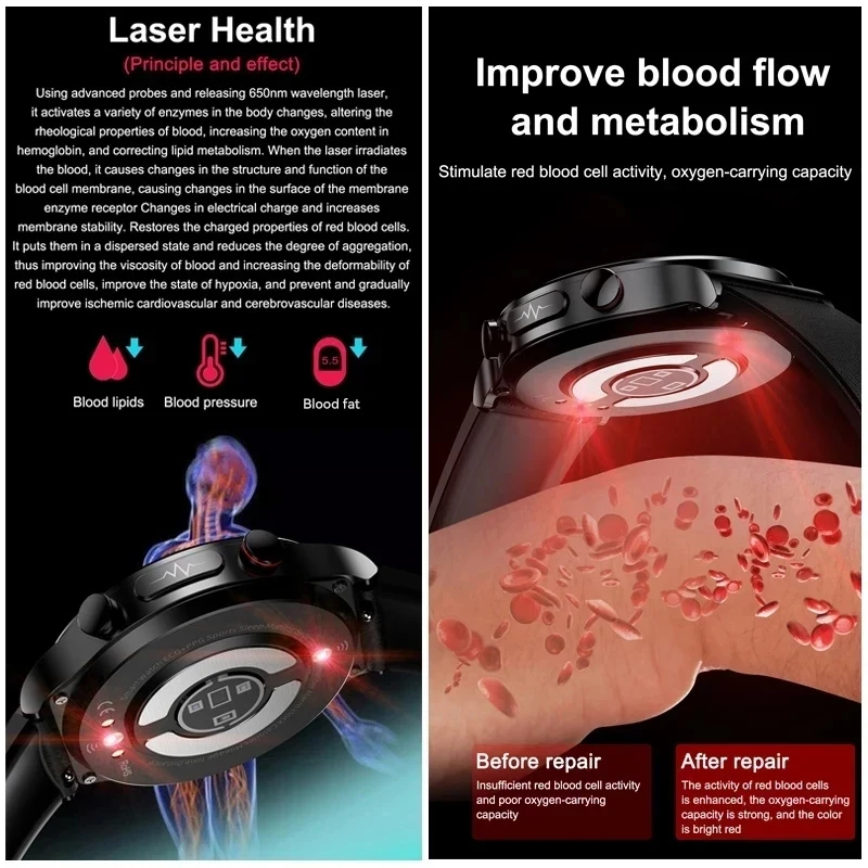 2025 New HOT Accurate Health Tracker Uric Acid Body Fat Smart watch laser Therapy Watches Bluetooth Call ECG+PPG Smart Watch Man