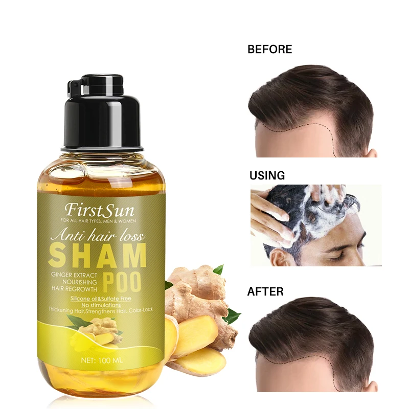 

100ml ginger shampoo Anti-hair loss repair dry hair Gentle does not hurt scalp Regulate oil secretion Improve scalp condition