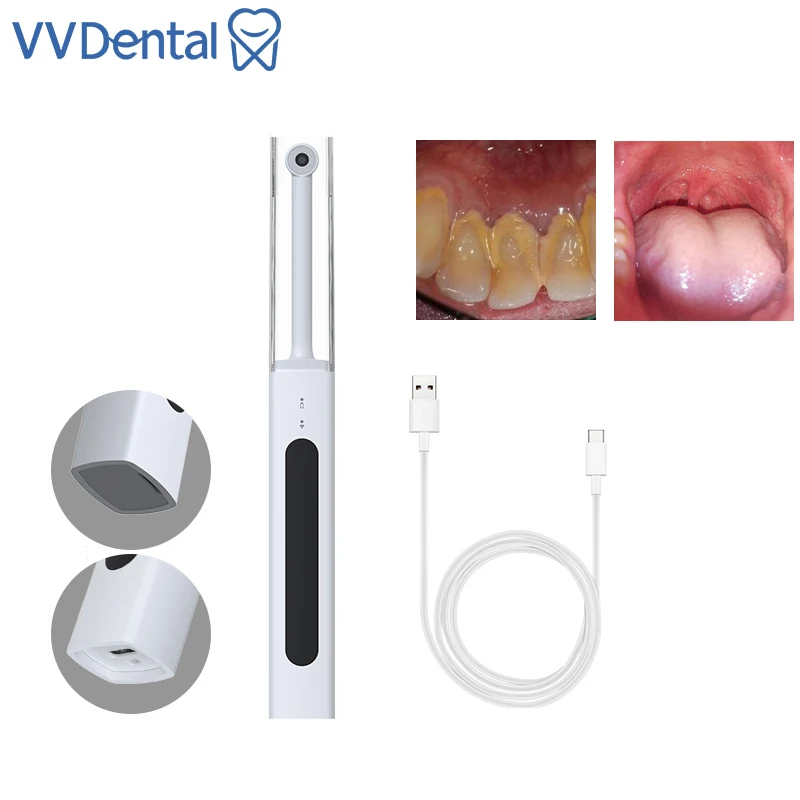 

VVDental Dental Intraoral Camera Wireless HDMI Wifi Endoscope Dental Endoscope For PC IOS Android Phone