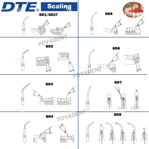 Imagen 2 del producto Puntas de escalador ultrasónico Dental Woodpecker DTE, puntas de escalado de endodoncia para periodoncia, compatibles con escalador NSK SATELEC, herramientas dentales