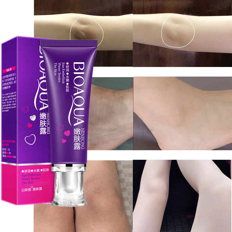 

30g Whitening Cream Private Parts Whitening Cream Arm Thigh Body Knees Whitening Brighten Skin Mild Non-irritating Body Care