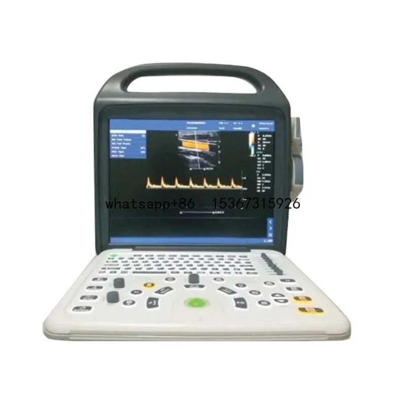 HEDY P50 CE portable laptop color doppler 2D 3D ultrasound scanner machine price