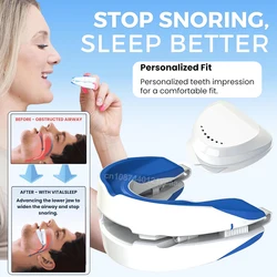 Anti-Snoring Mouthpiece Anti-Snoring Device Night Time Teeth Mouthguard Adjustable Sleeping Mouth Guard for Bruxism Stop Snoring