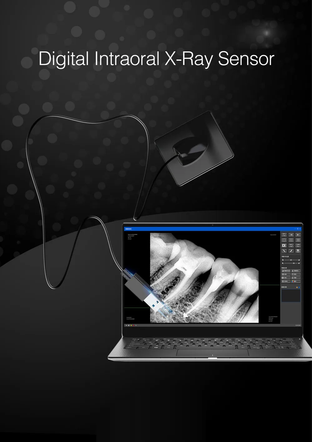 Low-Dose Digital Intraoral Dental XRay Sensor Image Sensor Size 0.8 & Size 1.5 with Sensor Positioner