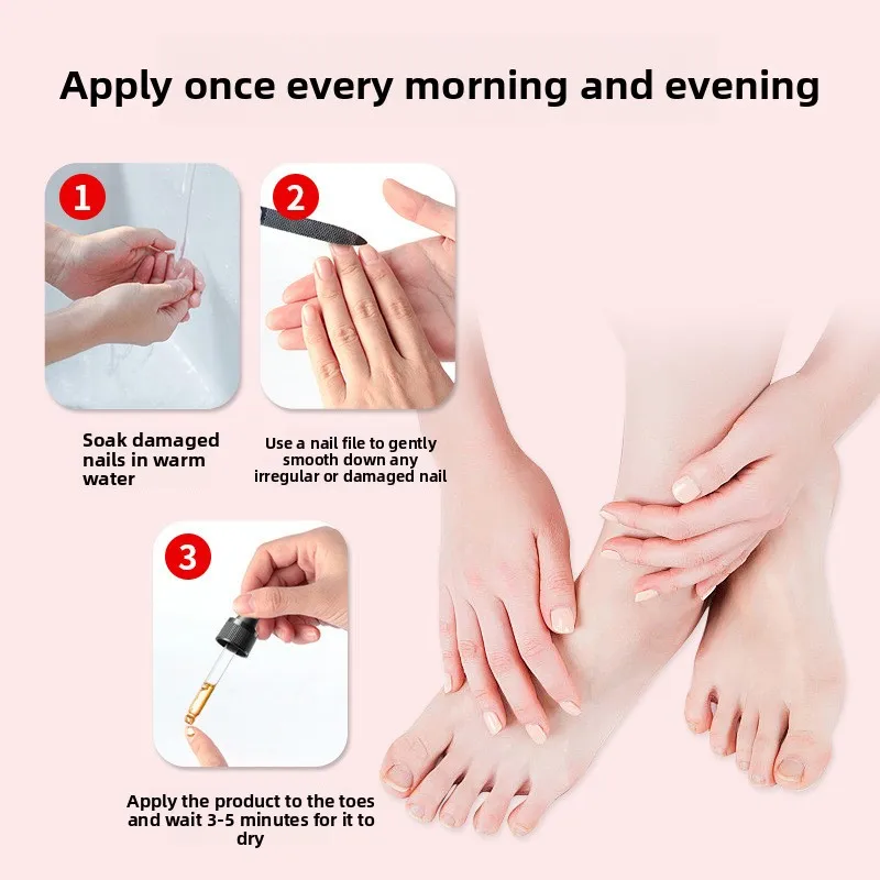 2026Pharmacy Toenail Fungus Treatment Kit, 25ml Repair Set with File, Bandages & Swabs for Thick Nails - view 2