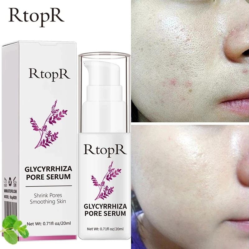 RtopR Glycyrrhiza Pore Refining Serum Quickly And Effectively Shrinks Pores Deeply Repairs Whitening Skin Enhances Facial Shine