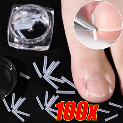 1-10 cajas elásticas en forma de C, tratamiento de relleno de tubo, cuidado de los pies, Clip alisador de ranura Invisible, herramientas correctoras de uñas encarnadas