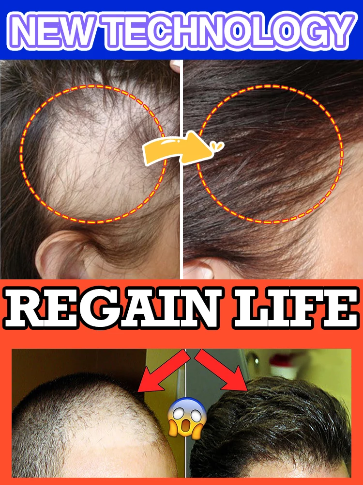 98-de-los-compradores-compran-de-nuevo-tienen-mas-y-mas-cabello-dios-adios-a-la-calvicie-cabello-grueso-producto-vendedor-caliente
