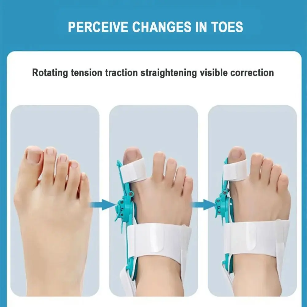 

Регулируемый корректор для пальцев стопы, фиксатор для вальгусной деформации, выпрямитель для большого пальца, поддержка при вывихах и переломах суставов