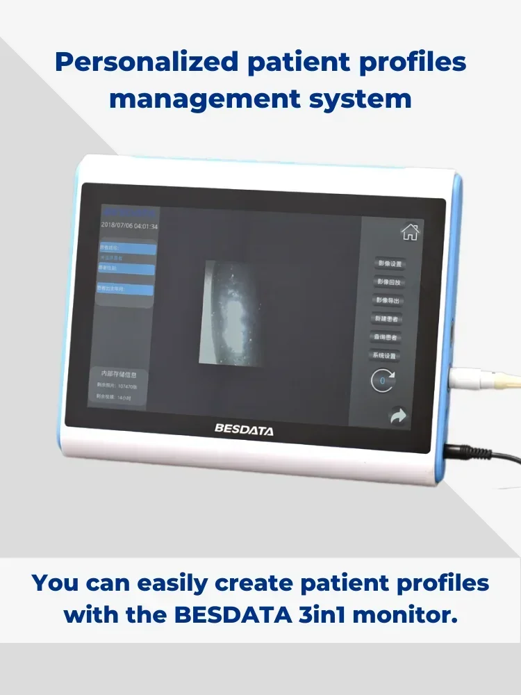 Медицинский моното BESDATA, интеллектуальный медицинский дисплей, моното для ларингоскопа, гастроскоп, риноскоп, бронхоскоп, эндоскоп