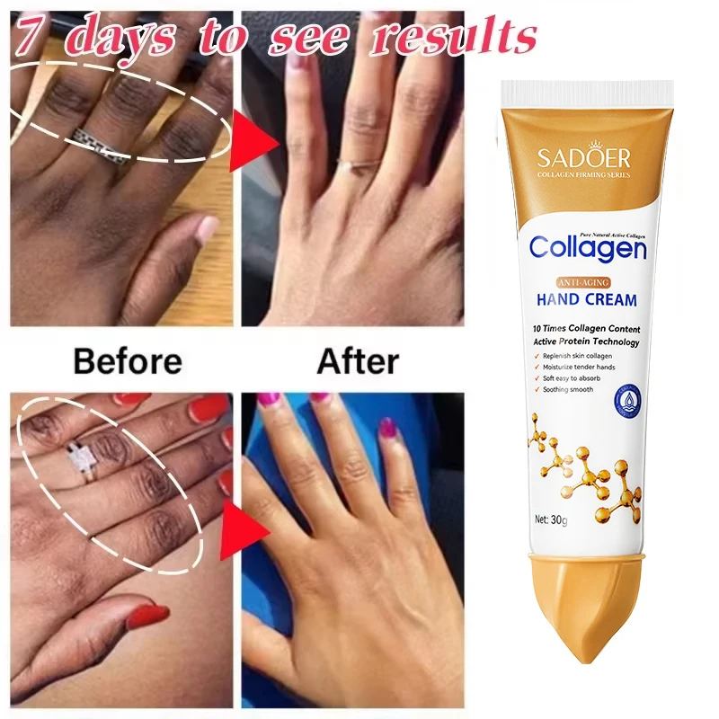 

Dark Knuckles Fast Brightening Serum Hand Anti Cracking Cream Fingers Brighten Moisturiz For Dark Skin Stains Remover Products