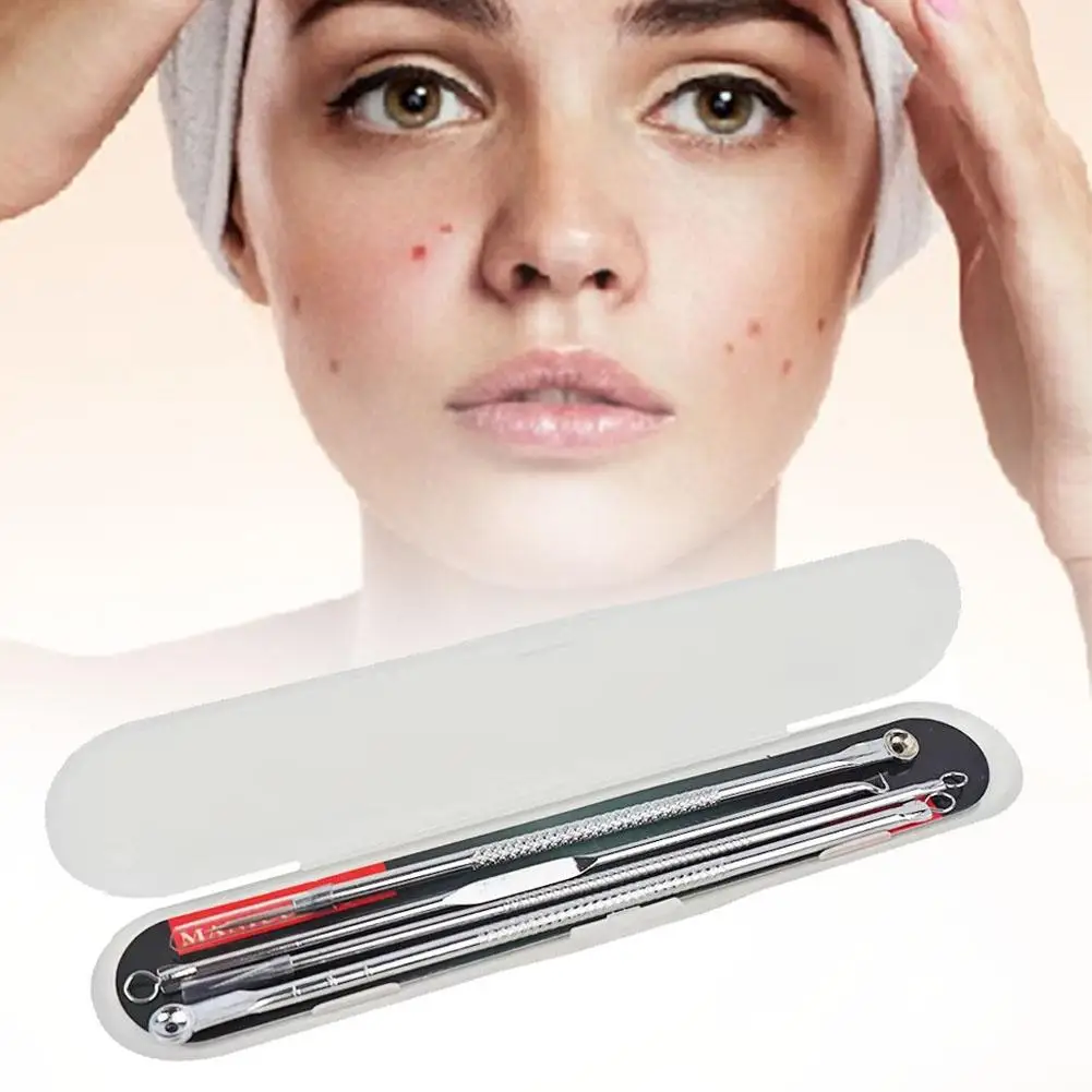 4Pcs Ultra-Precise Pimple Tweezers Set - Pro Acne and Blackhead Removal Tool -for Effective Face Care and Skin Purification