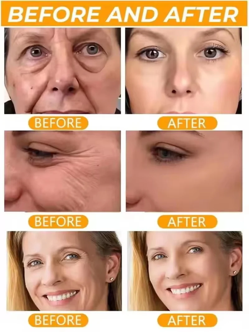 Collagen Protein Threads Instant Lifting Firming Absorbable Face Filler Anti-aging Deep Repair Fade Fine Lines Korean Cosmetics