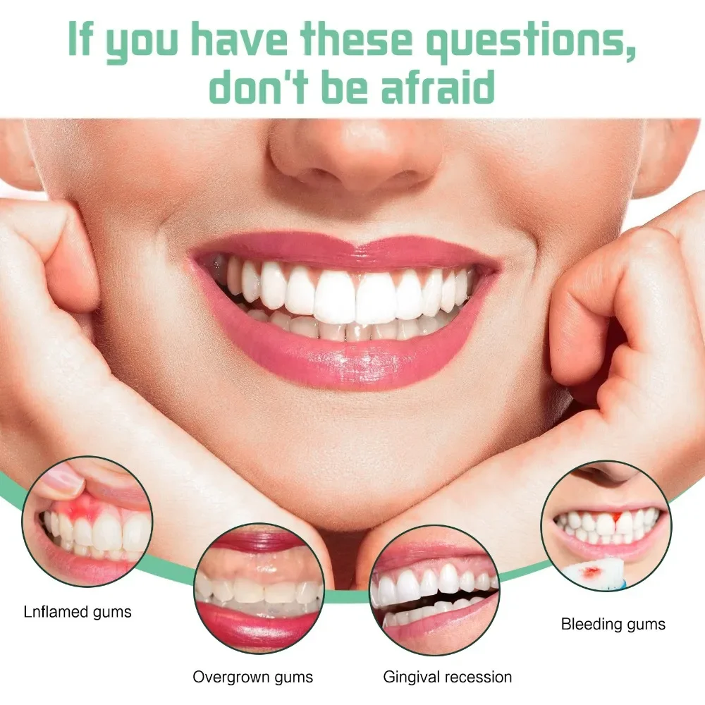 , Aliviar A Goma De Reparo Goma De Reparo Gengival Inchaço, Cuidados De Limpeza, Higiene Periodontal Oral, Remover Mancha, Tártaro Amarelo