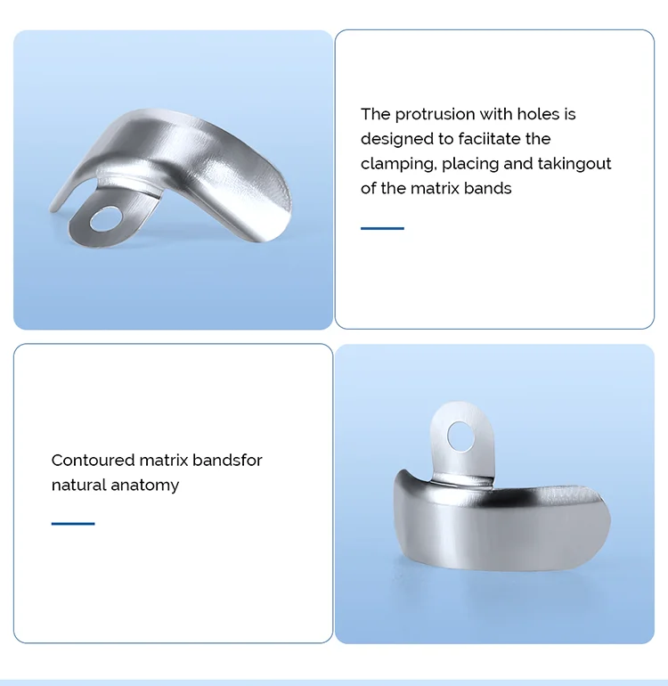 100 Stück AZDENT Dental Matrix Bands Steel Sectional Contoured Metal Matrices Matrix Size # 1/2/3/4 Zahnheilkundewerkzeuge autoklavierbar – Detail 4