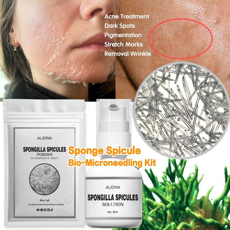 Kit de exfoliación de algas GD, blanqueamiento, melasma, algas marinas, bio para el tratamiento del acné, mascarilla de aguja de silicona de algas marinas faciales funcional