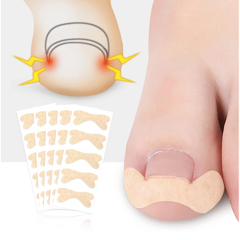 1 foglio incarnito punta piede adesivo per la correzione delle unghie Pedicure correttore dell'unghia del piede