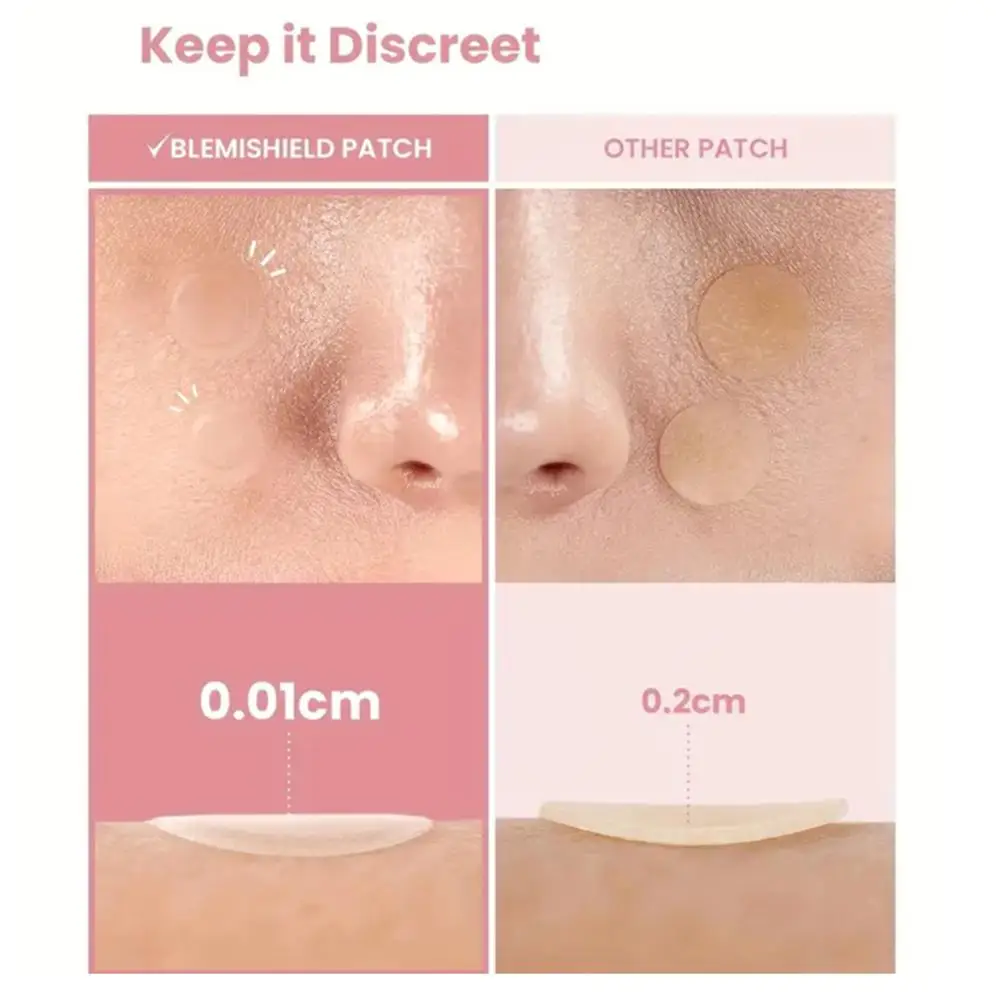 Toppe per brufoli per il viso 360 conteggi, stelle carine Cuori Punti Toppe idrocolloidali per l'acne per breakouts Zit Patch per brufoli Cura della pelle