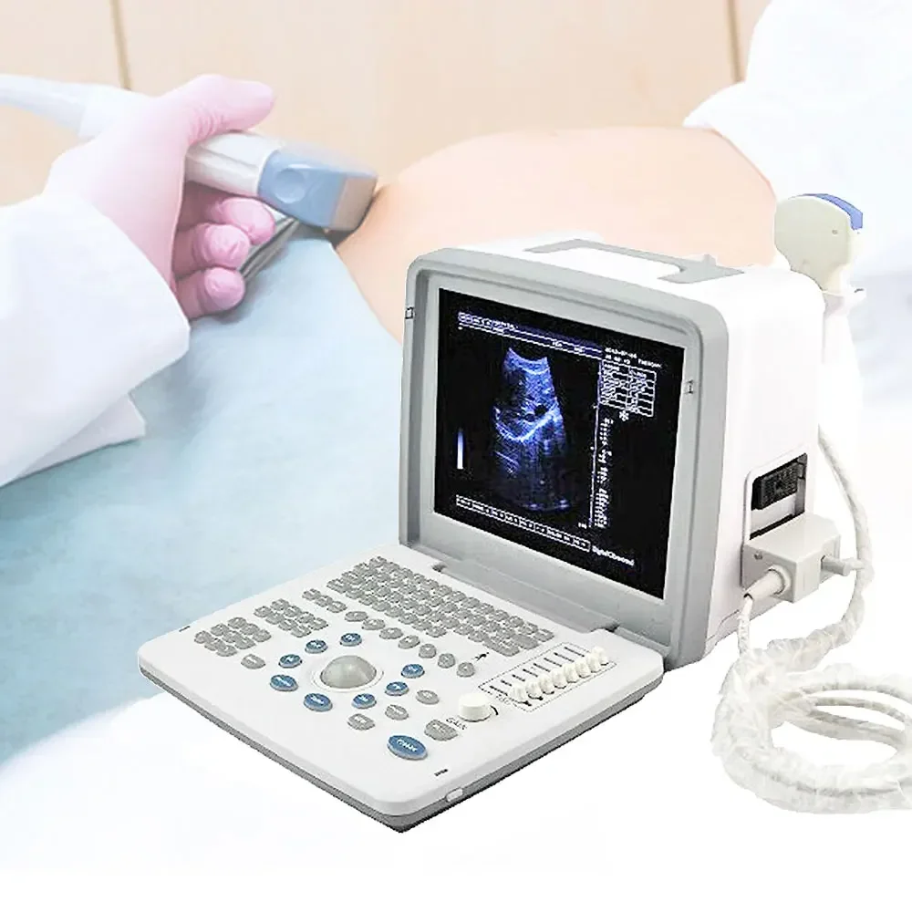 LTUB62 Promotion Price 12 Inch Portable Ultrasound Scanner Medical Ultrasound Instruments Echograph Machine For Human