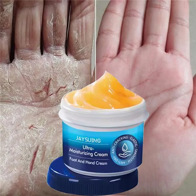 1Pc 40G Anti-Drogende Crack Voet Handcrème Hiel Gebarsten Reparatie Handvoeten Masker Hydraterende Whitening Dode Huid Verwijdering Huidverzorging